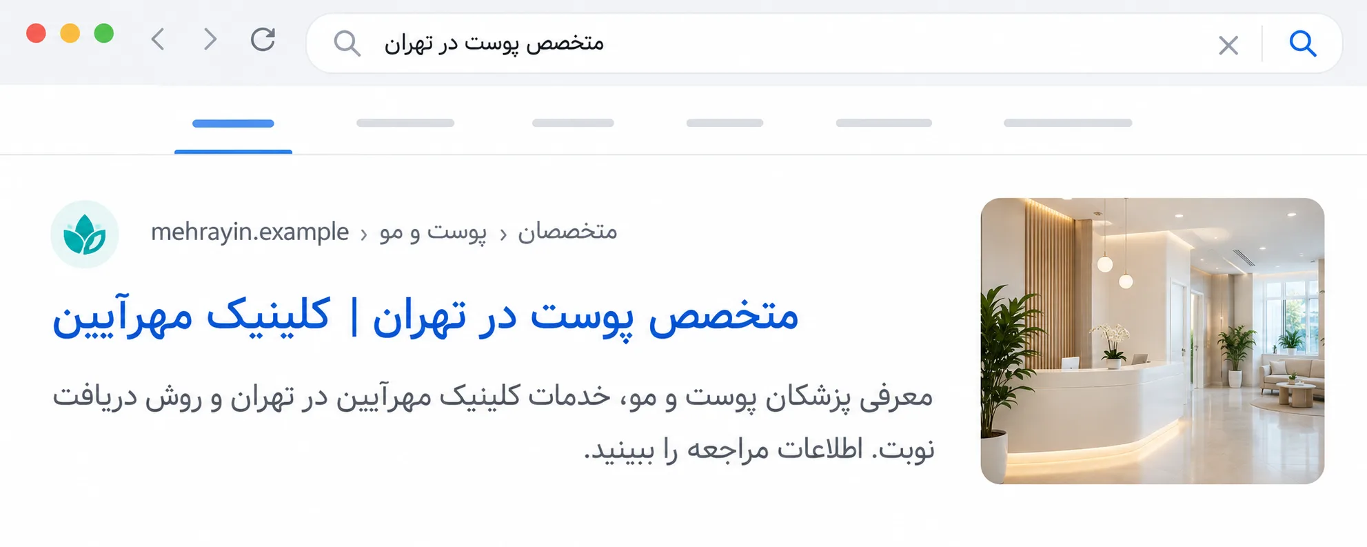 پیشنمایش نتیجهی جستوجوی یک کلینیک، شامل نشانی صفحه، عنوان، توضیح متا و تصویر فضای پذیرش کلینیک.