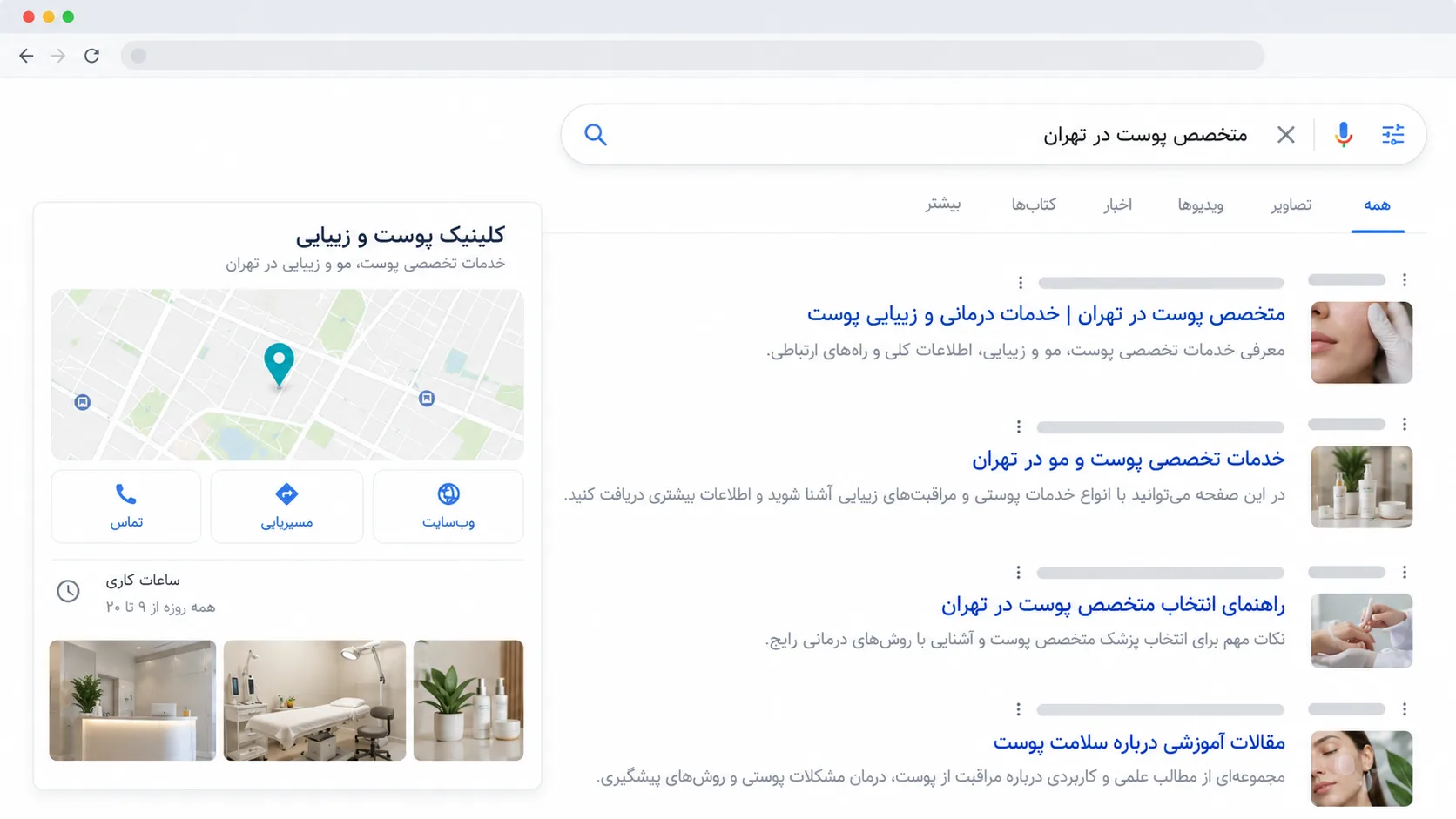 جستجوی کاربر در گوگل برای پیداکردن متخصص پوست در تهران